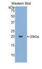 Acid Phosphatase antibody, LS-C301870, Lifespan Biosciences, Western Blot image 