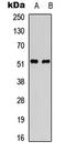 Parkin RBR E3 Ubiquitin Protein Ligase antibody, LS-C368456, Lifespan Biosciences, Western Blot image 