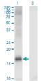 Lysine Demethylase 5A antibody, H00005927-M03, Novus Biologicals, Western Blot image 