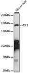 Tyrosine Kinase With Immunoglobulin Like And EGF Like Domains 1 antibody, LS-C750077, Lifespan Biosciences, Western Blot image 