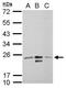 Mitochondrial Ribosome Recycling Factor antibody, GTX117629, GeneTex, Western Blot image 
