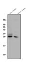 CD8 antibody, A02236-3, Boster Biological Technology, Western Blot image 