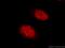 THO Complex 2 antibody, 55178-1-AP, Proteintech Group, Immunofluorescence image 