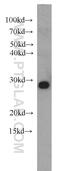 Nipsnap Homolog 3A antibody, 10751-1-AP, Proteintech Group, Western Blot image 