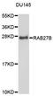 RAB27B, Member RAS Oncogene Family antibody, STJ111468, St John