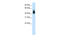 SRY-Box 3 antibody, 28-912, ProSci, Enzyme Linked Immunosorbent Assay image 