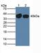 Serpin Family A Member 7 antibody, LS-C296652, Lifespan Biosciences, Western Blot image 