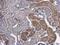 Psat antibody, GTX633623, GeneTex, Immunohistochemistry paraffin image 