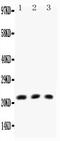 Lymphotoxin Alpha antibody, PA1361-1, Boster Biological Technology, Western Blot image 