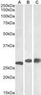 Phosphoglycerate Mutase 1 antibody, STJ70009, St John