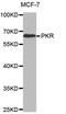 Eukaryotic Translation Initiation Factor 2 Alpha Kinase 2 antibody, MBS129254, MyBioSource, Western Blot image 