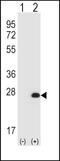 Hypoxanthine Phosphoribosyltransferase 1 antibody, MBS9208723, MyBioSource, Western Blot image 