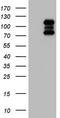 Histone Deacetylase 4 antibody, TA805008, Origene, Western Blot image 
