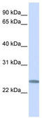 C12orf49 antibody, TA338672, Origene, Western Blot image 