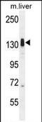 Lemur Tyrosine Kinase 3 antibody, PA5-71550, Invitrogen Antibodies, Western Blot image 
