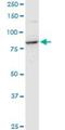 Ribonucleotide Reductase Catalytic Subunit M1 antibody, H00006240-M08, Novus Biologicals, Western Blot image 