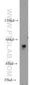 RCC1 And BTB Domain Containing Protein 2 antibody, 13225-1-AP, Proteintech Group, Western Blot image 