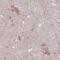 Potassium Voltage-Gated Channel Subfamily A Member Regulatory Beta Subunit 1 antibody, NBP1-90194, Novus Biologicals, Immunohistochemistry paraffin image 