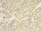 FYN Proto-Oncogene, Src Family Tyrosine Kinase antibody, orb354987, Biorbyt, Immunohistochemistry paraffin image 