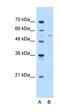 Fatty Acyl-CoA Reductase 2 antibody, orb325340, Biorbyt, Western Blot image 