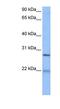 Epithelial Cell Transforming 2 antibody, NBP1-58303, Novus Biologicals, Western Blot image 