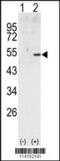 Cyclin A2 antibody, 62-798, ProSci, Western Blot image 