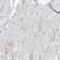 O-GlcNAcase antibody, NBP1-81244, Novus Biologicals, Immunohistochemistry paraffin image 