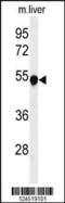 Phenylalanine Hydroxylase antibody, 61-711, ProSci, Western Blot image 
