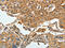 Adaptor Protein, Phosphotyrosine Interacting With PH Domain And Leucine Zipper 1 antibody, CSB-PA089809, Cusabio, Immunohistochemistry paraffin image 