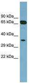 Glyoxalase Domain Containing 4 antibody, TA345068, Origene, Western Blot image 