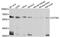 Chaperonin Containing TCP1 Subunit 6A antibody, A3589, ABclonal Technology, Western Blot image 