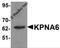 Karyopherin Subunit Alpha 6 antibody, 5991, ProSci Inc, Western Blot image 