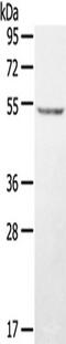 Serine/Threonine/Tyrosine Kinase 1 antibody, TA351767, Origene, Western Blot image 