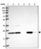 Glucosamine-Phosphate N-Acetyltransferase 1 antibody, PA5-60788, Invitrogen Antibodies, Western Blot image 