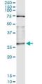 OTU Deubiquitinase, Ubiquitin Aldehyde Binding 2 antibody, H00078990-M14, Novus Biologicals, Immunoprecipitation image 