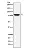 Inhibitor Of Nuclear Factor Kappa B Kinase Subunit Epsilon antibody, M01816, Boster Biological Technology, Western Blot image 