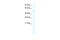 Aristaless Related Homeobox antibody, 28-568, ProSci, Western Blot image 