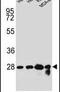 CPT1 antibody, PA5-23695, Invitrogen Antibodies, Western Blot image 