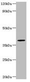 Arylsulfatase B antibody, LS-C677200, Lifespan Biosciences, Western Blot image 