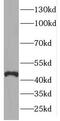 Elongator Acetyltransferase Complex Subunit 4 antibody, FNab02749, FineTest, Western Blot image 