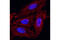 Coilin antibody, 14168T, Cell Signaling Technology, Immunocytochemistry image 