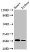 Chorionic Somatomammotropin Hormone 2 antibody, CSB-PA006054LA01HU, Cusabio, Western Blot image 