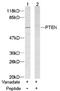 Phosphatase And Tensin Homolog antibody, AP02598PU-S, Origene, Western Blot image 