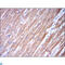 Troponin I2, Fast Skeletal Type antibody, LS-C812792, Lifespan Biosciences, Immunohistochemistry paraffin image 