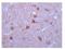 Mitogen-Activated Protein Kinase Kinase 2 antibody, ab69502, Abcam, Immunohistochemistry paraffin image 