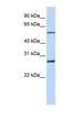 IBR domain-containing protein 1 antibody, NBP1-59776, Novus Biologicals, Western Blot image 