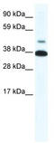Thyroid Hormone Receptor Beta antibody, TA339056, Origene, Western Blot image 