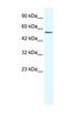 Zinc Finger Protein 286A antibody, NBP1-80119, Novus Biologicals, Western Blot image 