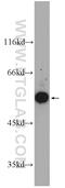 Rho GDP Dissociation Inhibitor Alpha antibody, 10249-1-AP, Proteintech Group, Western Blot image 