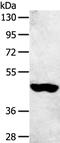 Sulfotransferase Family 2B Member 1 antibody, PA5-50797, Invitrogen Antibodies, Western Blot image 